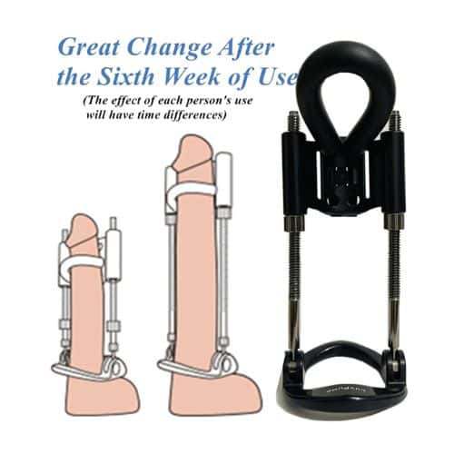 Penis Extender Device Kit Penile Traction Device - Detail View