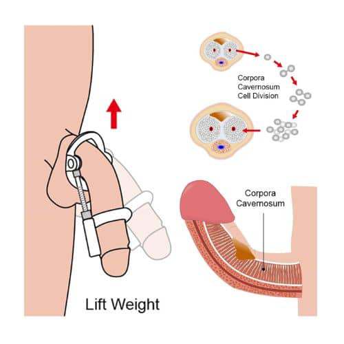 ExtendPro Penile Traction Device Kit - Side View
