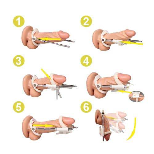 ExtendPro Penile Traction Device Kit - Detail View